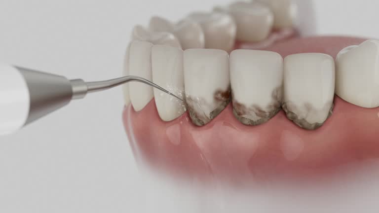 Reliable Emergency Dentist contractor in Derby, CO by Smile Center Dentistry